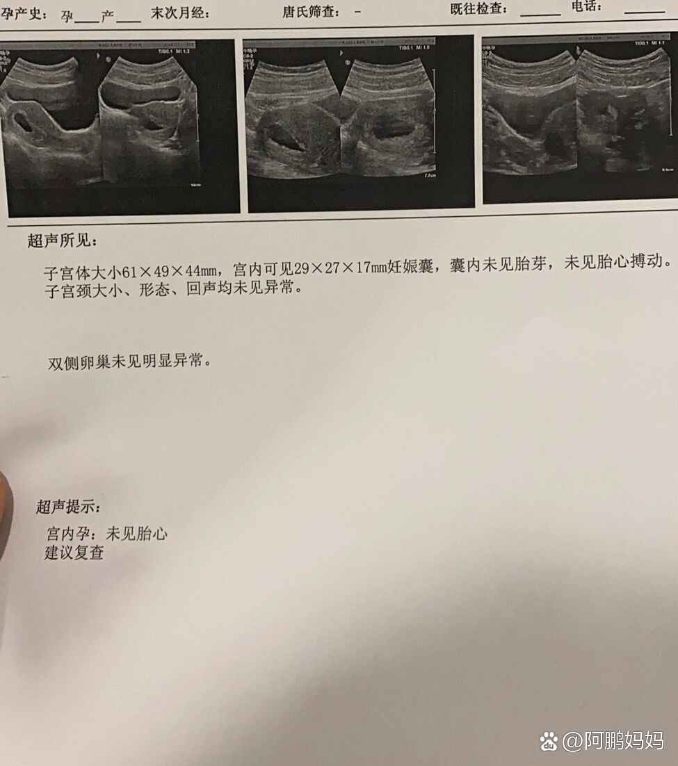 分享实测“有没有优乐字牌可以装挂吗”分享用挂教程-第2张图片