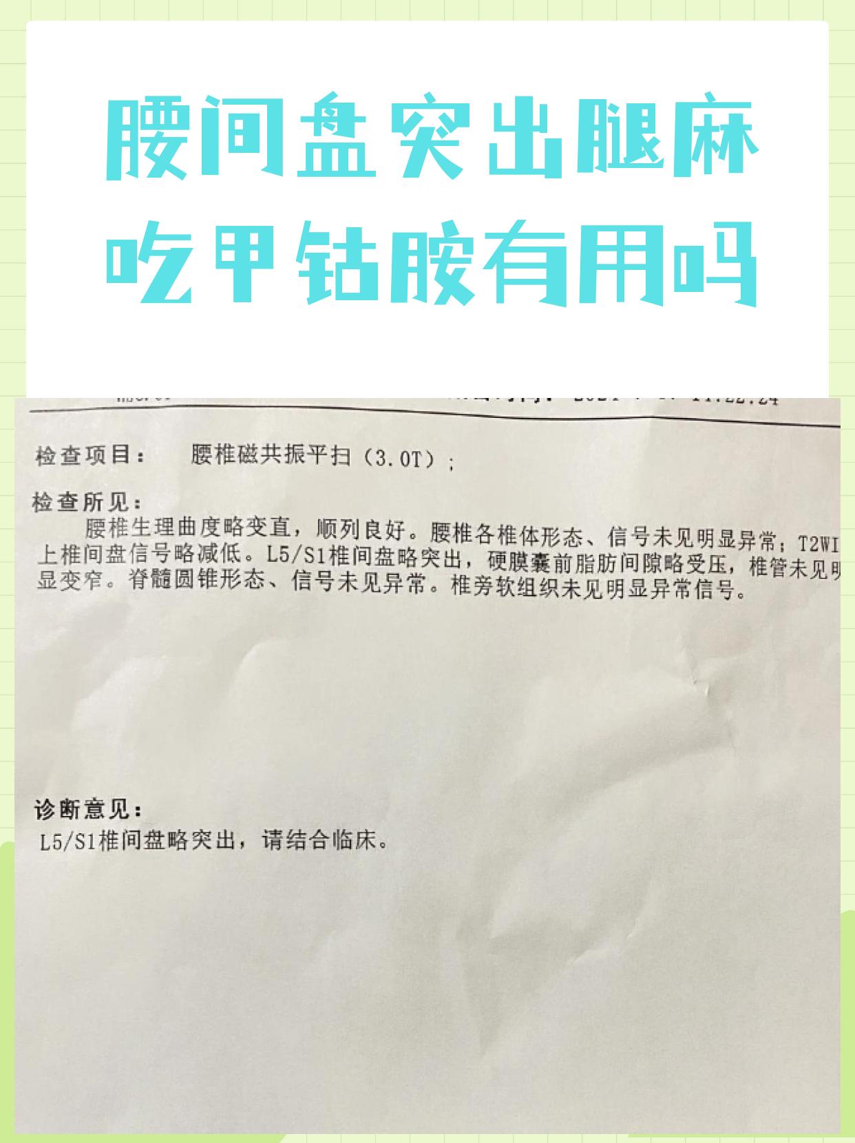 查到实测辅助“打麻将包赢神器是真的吗”(原来真的有挂)-第3张图片