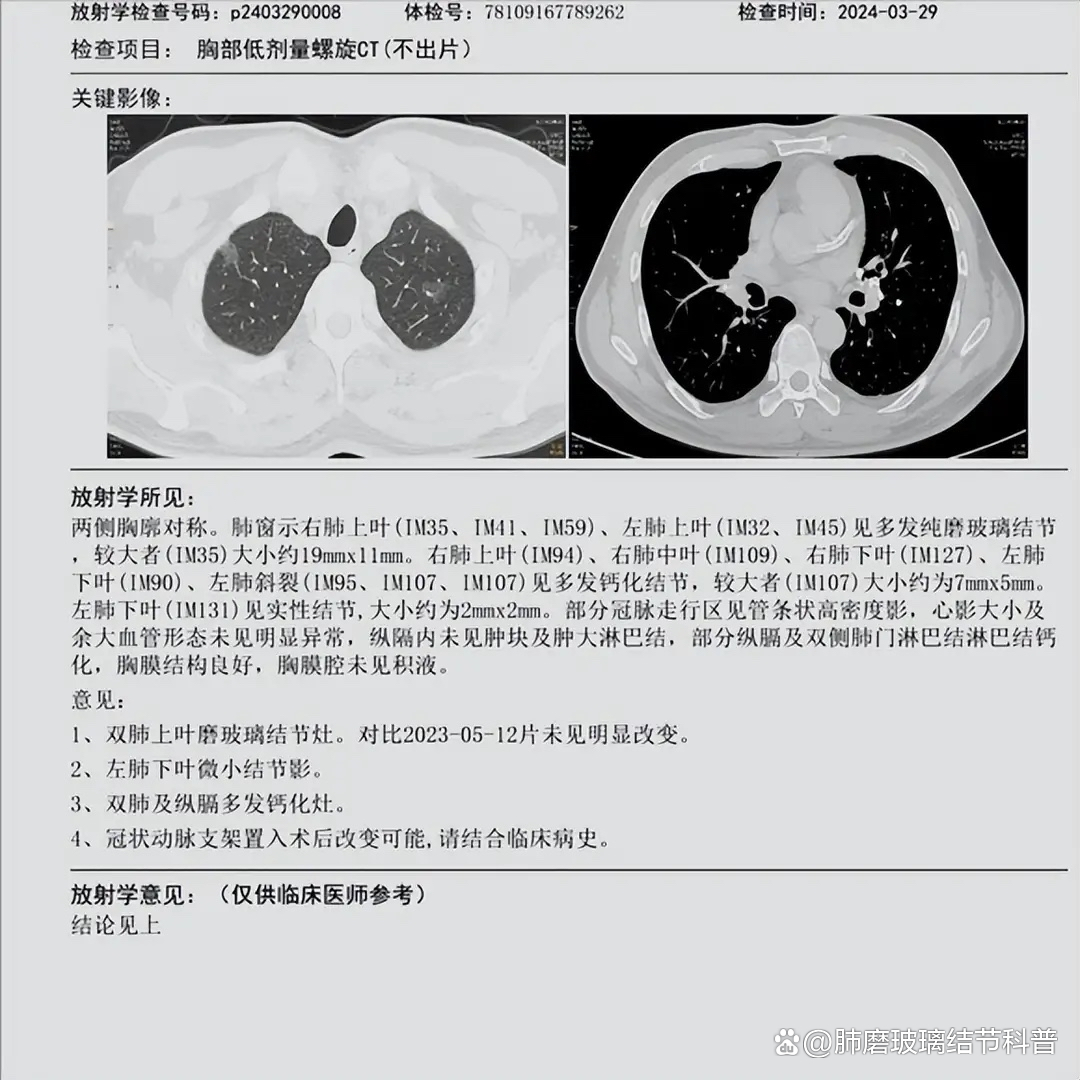 云南首例病例治愈〃云南确诊首例新型肺炎病例-第2张图片